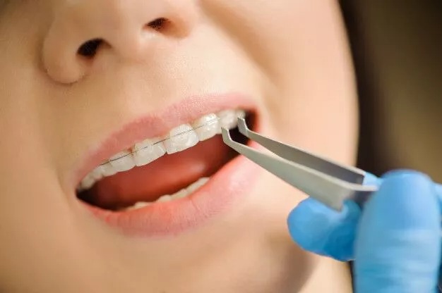What Is The Better Alternative To Dental Implants?